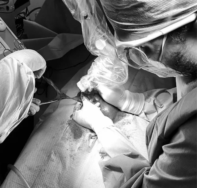 urologo-carrillo-circuncision-4